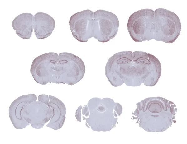 TDP-43 deltaNLS Transgenic ALS Mouse Model