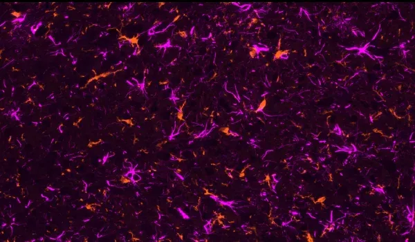 Images d'immunofluorescence chez des souris AAV-Tau