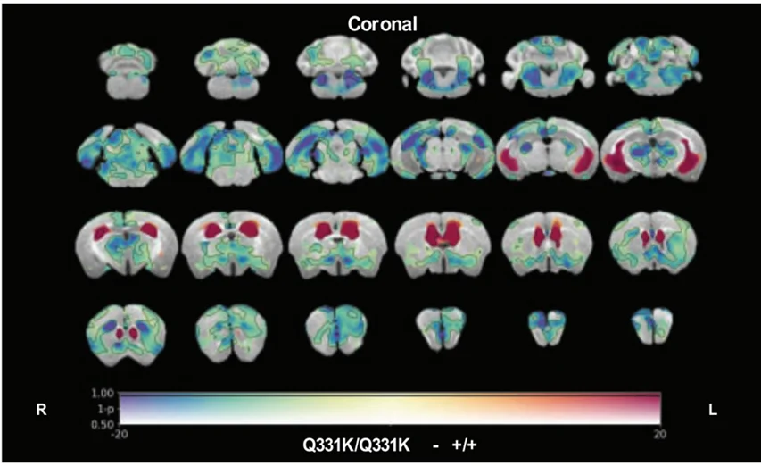 A Guide to Mouse Models of Frontotemporal Dementia (FTD)