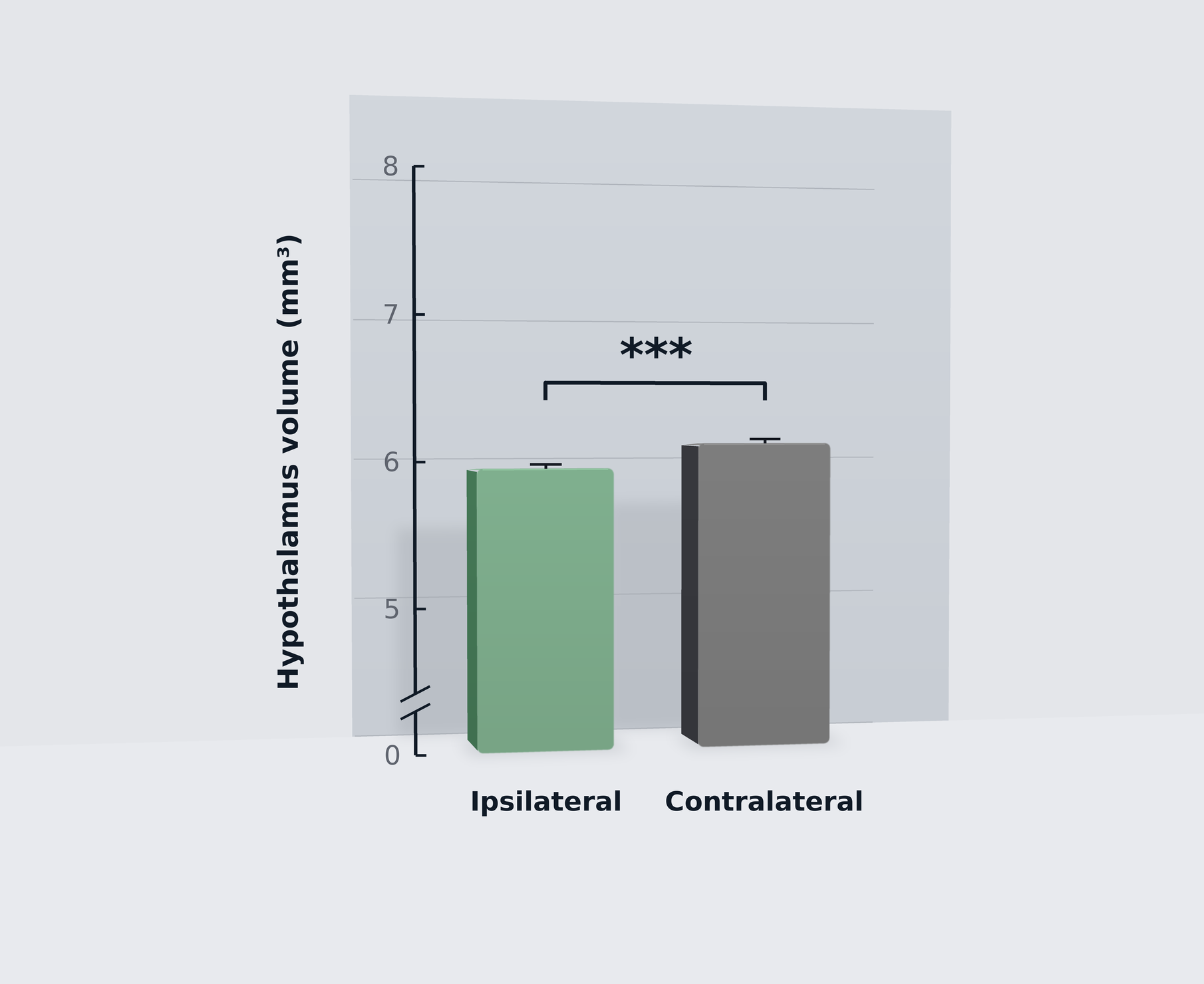 Reduced ipsilateral hypothalamic volume in AAV-Tau mice.