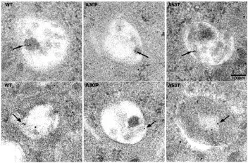 Alpha-synucléine à l'intérieur de vésicules à morphologie autophagique.