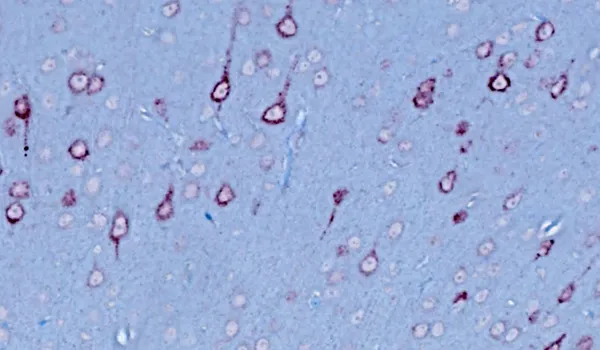 Staining used to highlight areas of neuronal degeneration or the presence of inclusions characteristic of the disease within the nervous system tissue