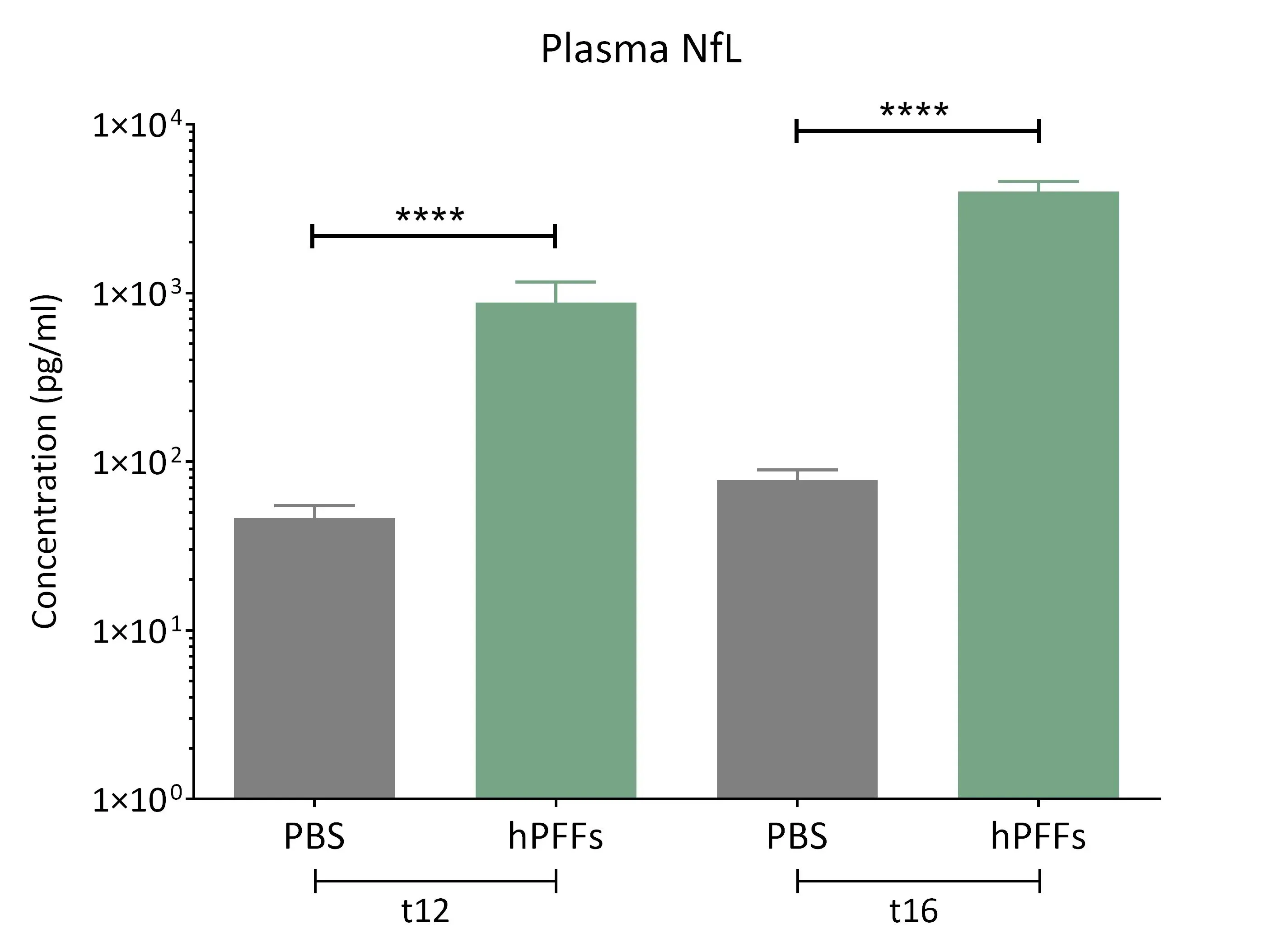 Graphs showing elevated NF-L levels in plasma