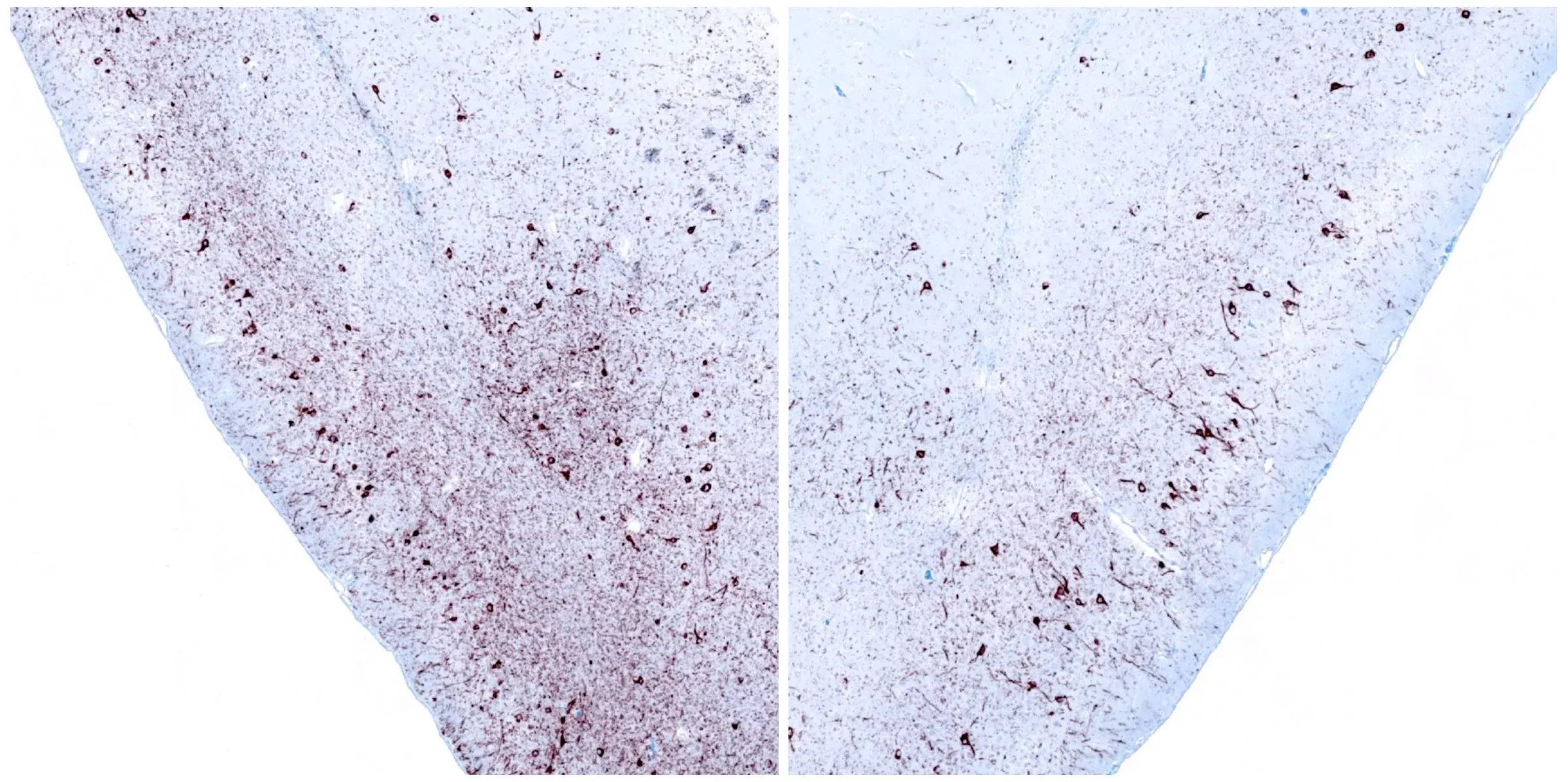 Deux coupes de tissu cérébral traitées par immunohistochimie (IHC) pour mettre en évidence l'alpha-synucléine phosphorylée, qui est importante dans le contexte de la recherche sur la maladie de Parkinson