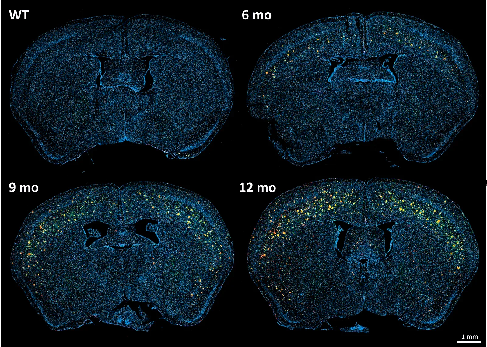 Coupes cérébrales de souris transgéniques APP/PS1 (ARTE10) et de souris de type sauvage à différents moments.