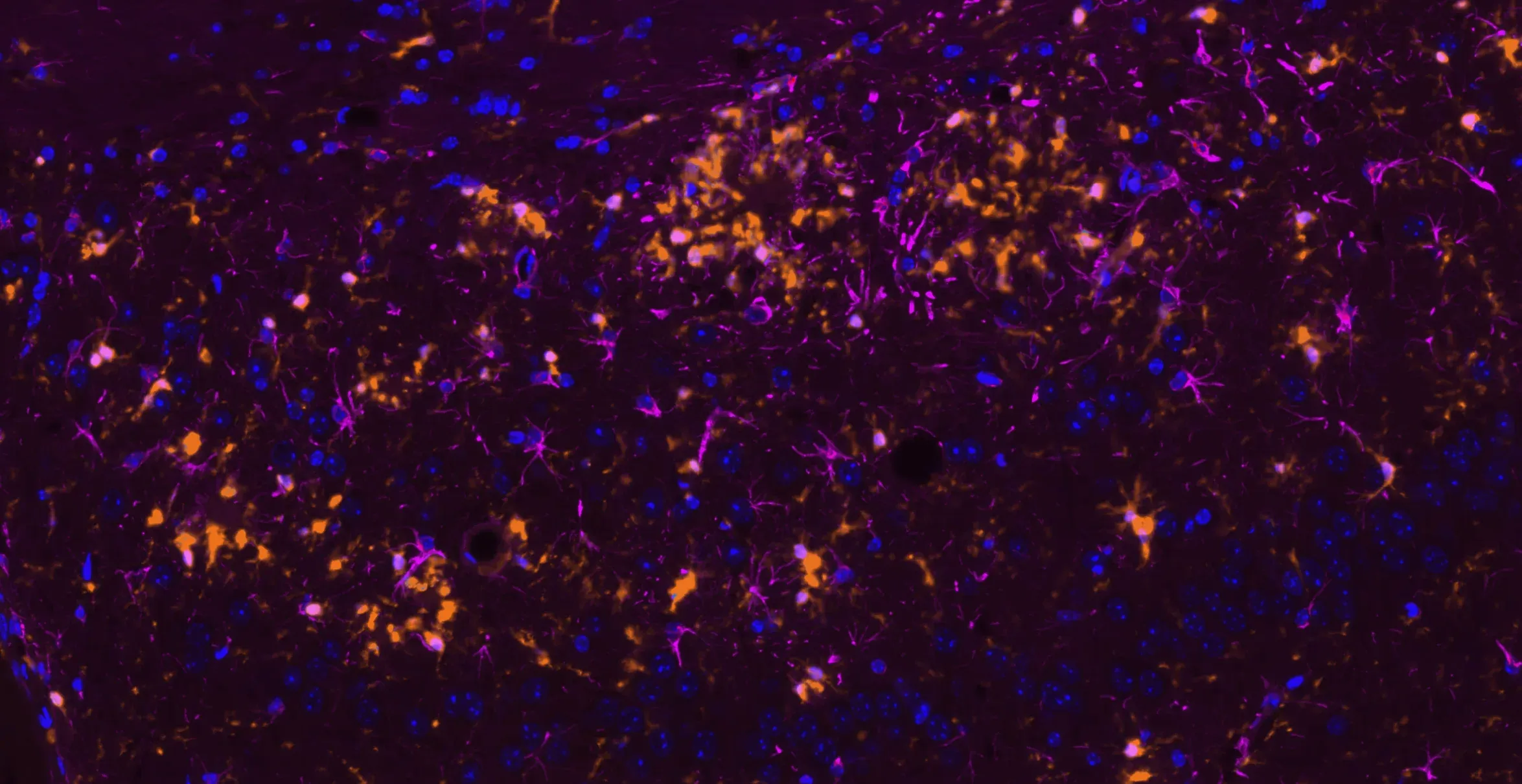 Astrocytes & microglia in APP/PS1 mice.
