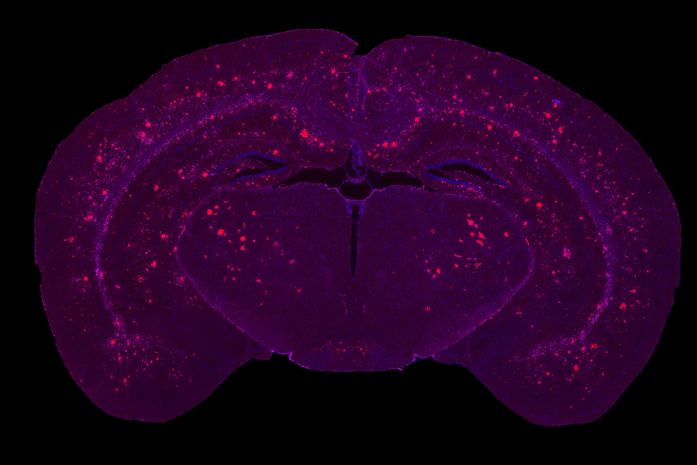mIF of APP/PS1 showing amyloid plaques