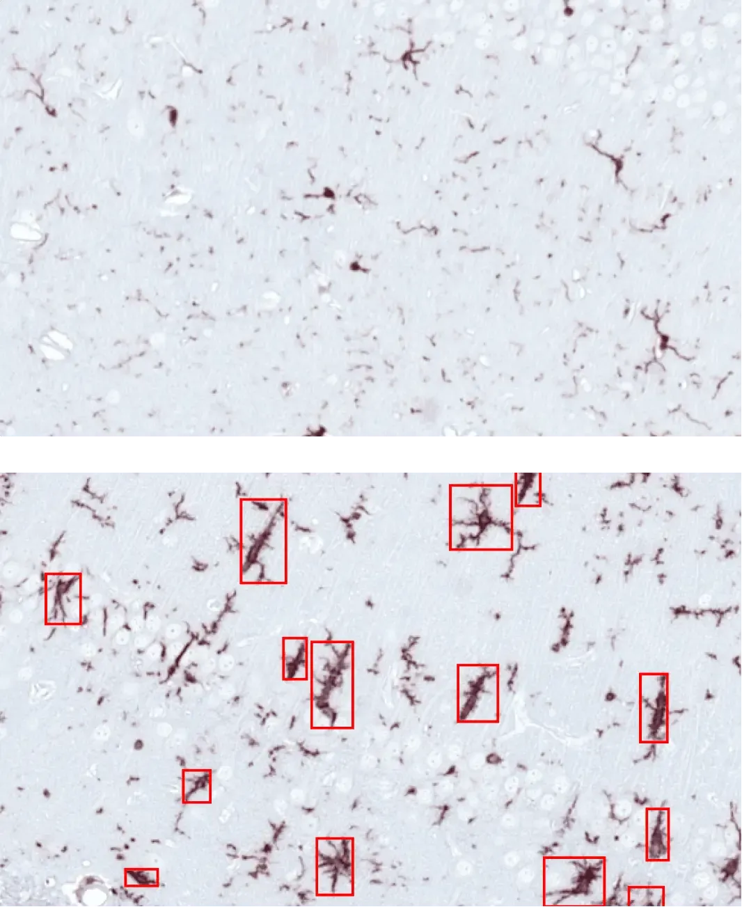 Images showing activated Microglia & Reactive Astrocytes