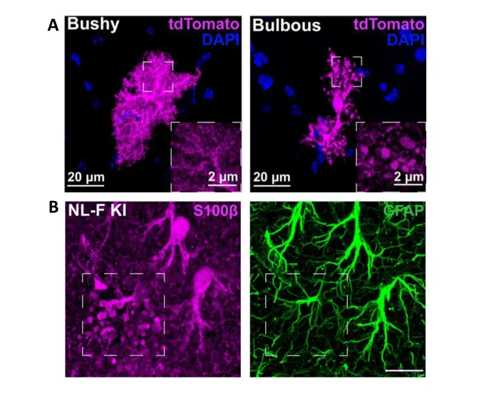 Identification of a new astrocyte morphology, named “bulbous”