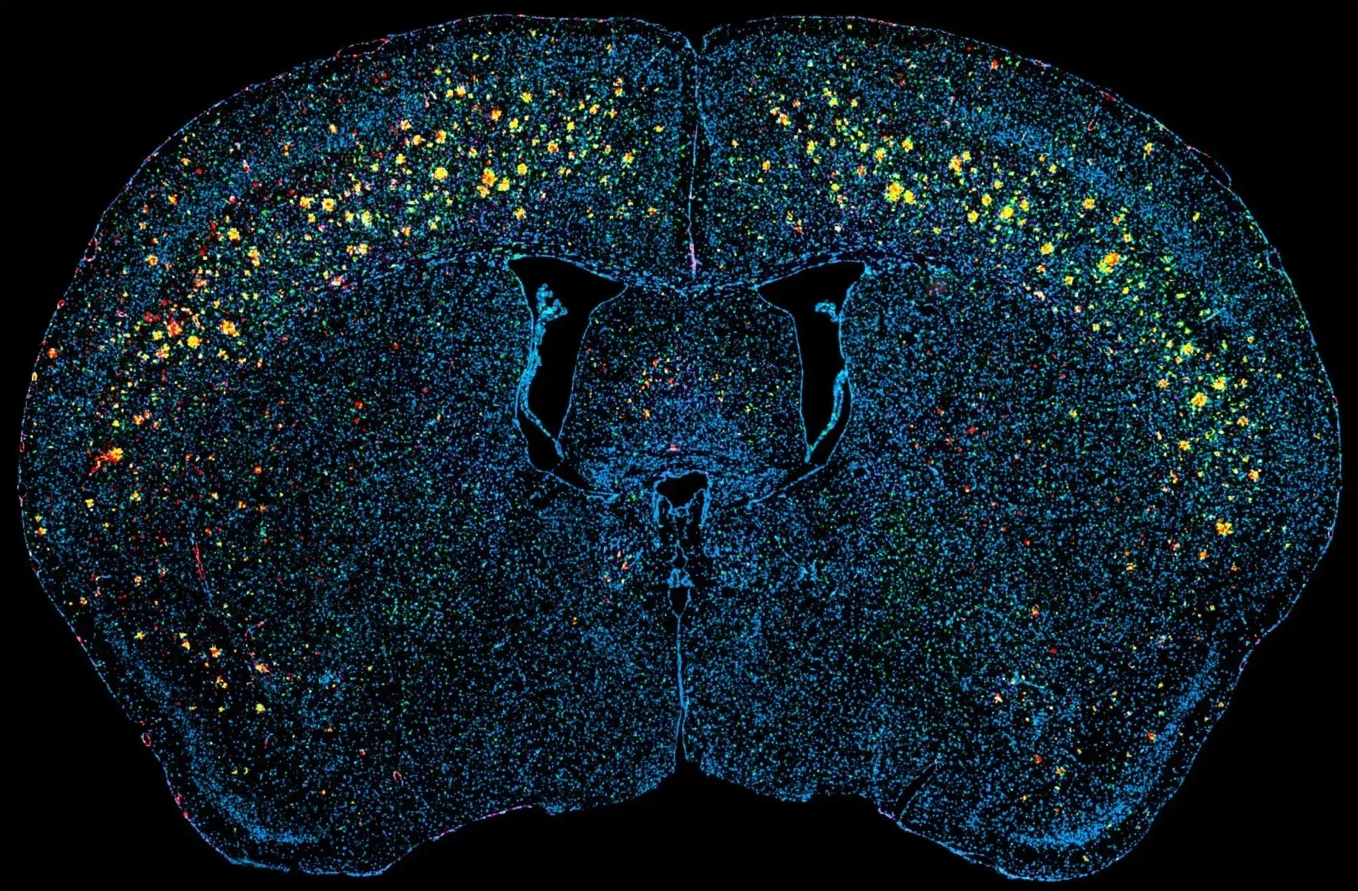Beta-amyloid plaques in an APP/PS1 transgenic mouse model