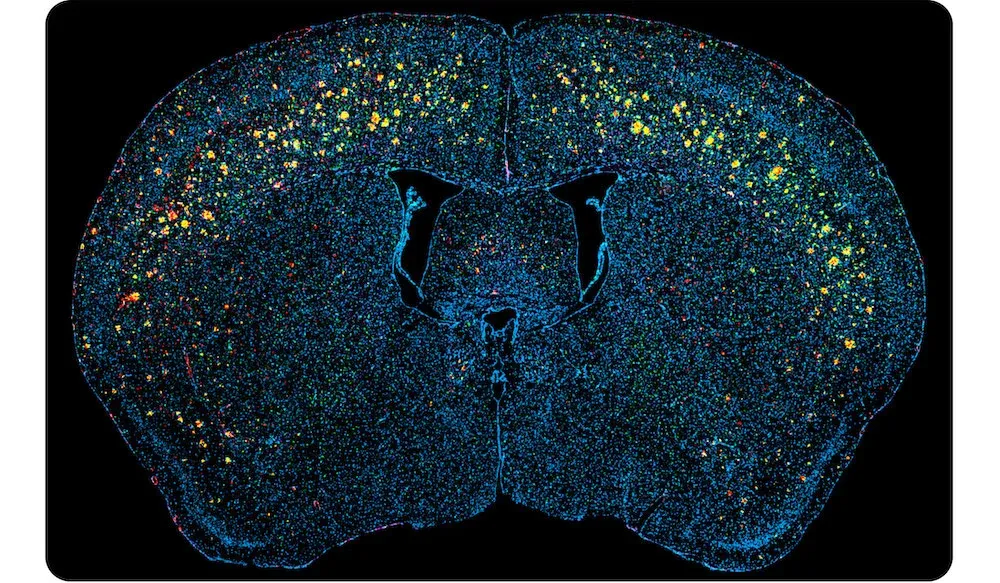 Beta-amyloid Model mIF Scan