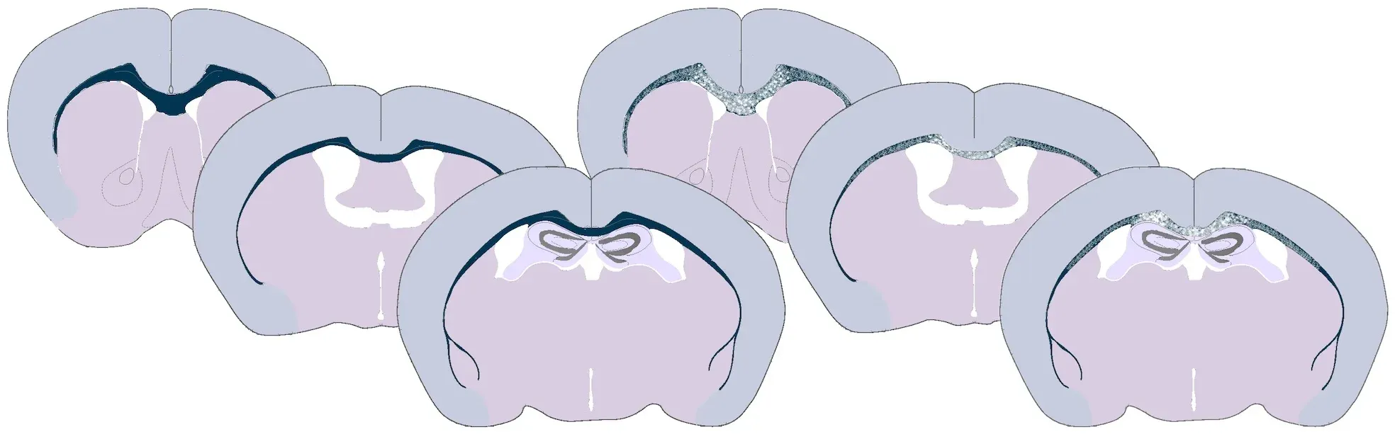 Illustration of demyelination in the corpus callosum of cuprizone-fed mice