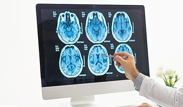 Person pointing at MRI brain scan images on a monitor