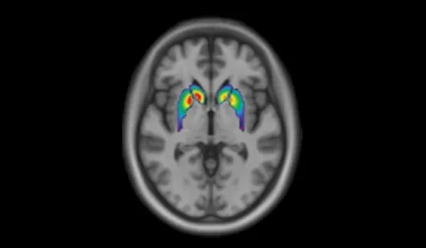 Dopaminergic Imaging of human brain