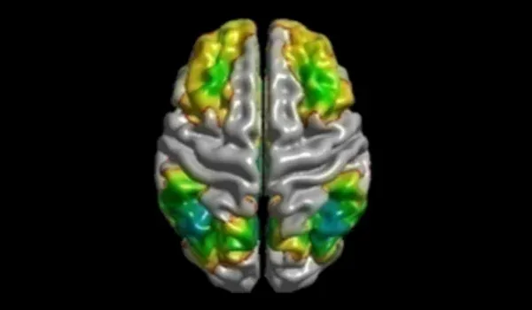 fMRI of human brain