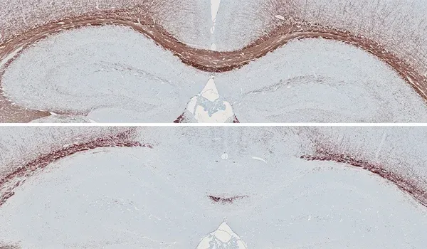 Two brain cross-sections stained for Myelin Basic Protein (MBP), used in studying demyelination in a cuprizone mouse model of Multiple Sclerosis (MS), with varying levels of myelin indicated by the staining intensity