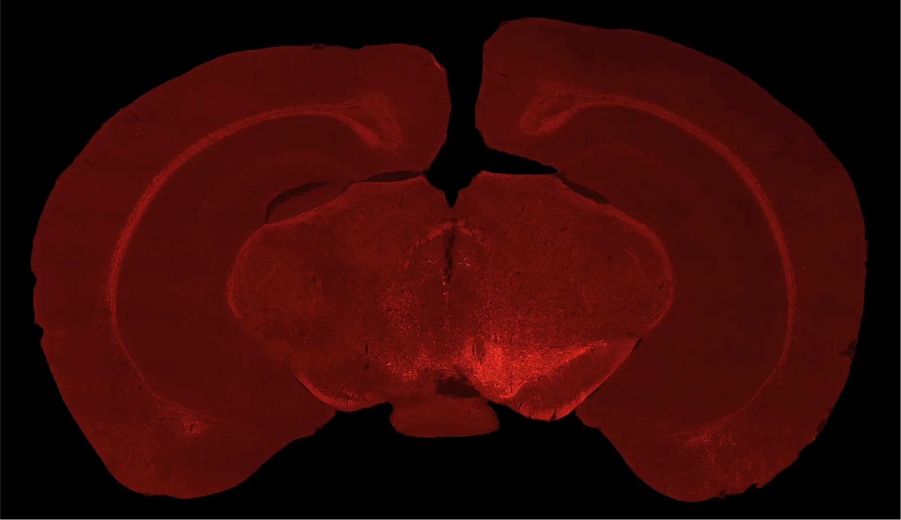 Immunofluorescence de la tyrosine hydroxylase démontrant la perte de neurones dopaminergiques