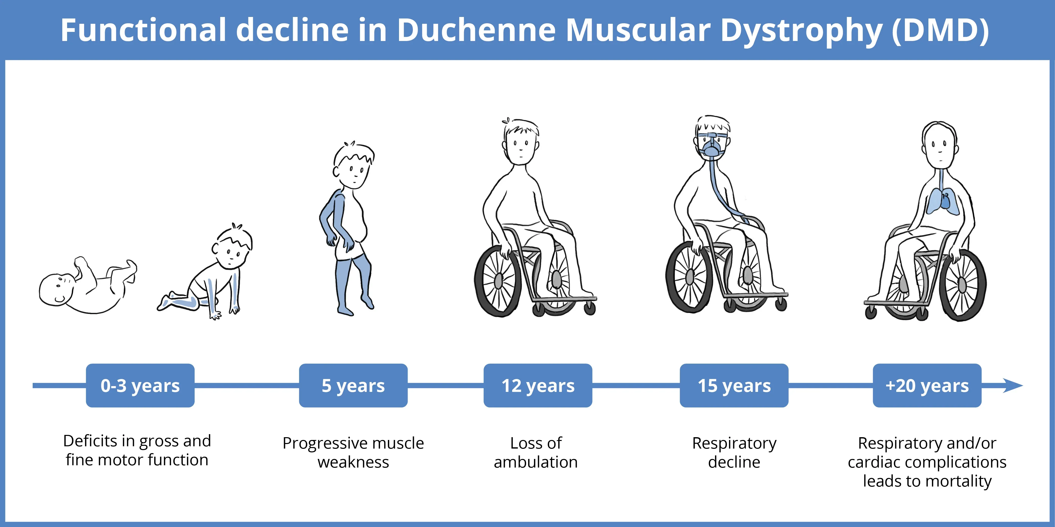 What Is The Life Expectancy Of A Boy With Duchenne Muscular Dystrophy