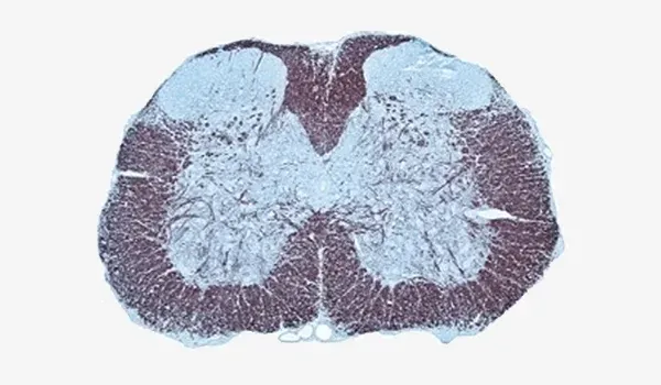 Coupe histologique, souvent utilisée dans l'étude des modèles d'encéphalomyélite auto-immune expérimentale (EAE)