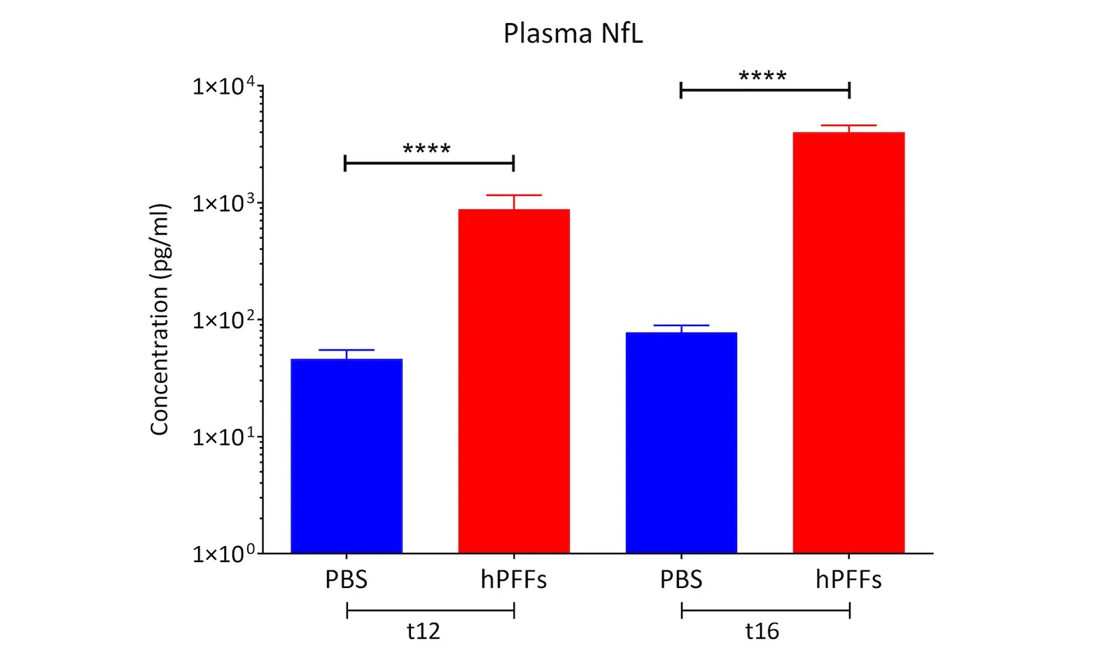 Graphique NfL du plasma d'AON