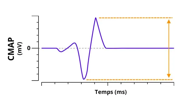 Electrophysiologie - Graphique du CMAP