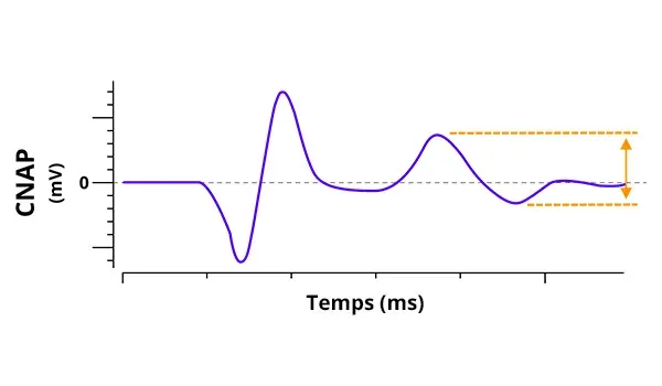 Electrophysiologie - Graphique CNAP