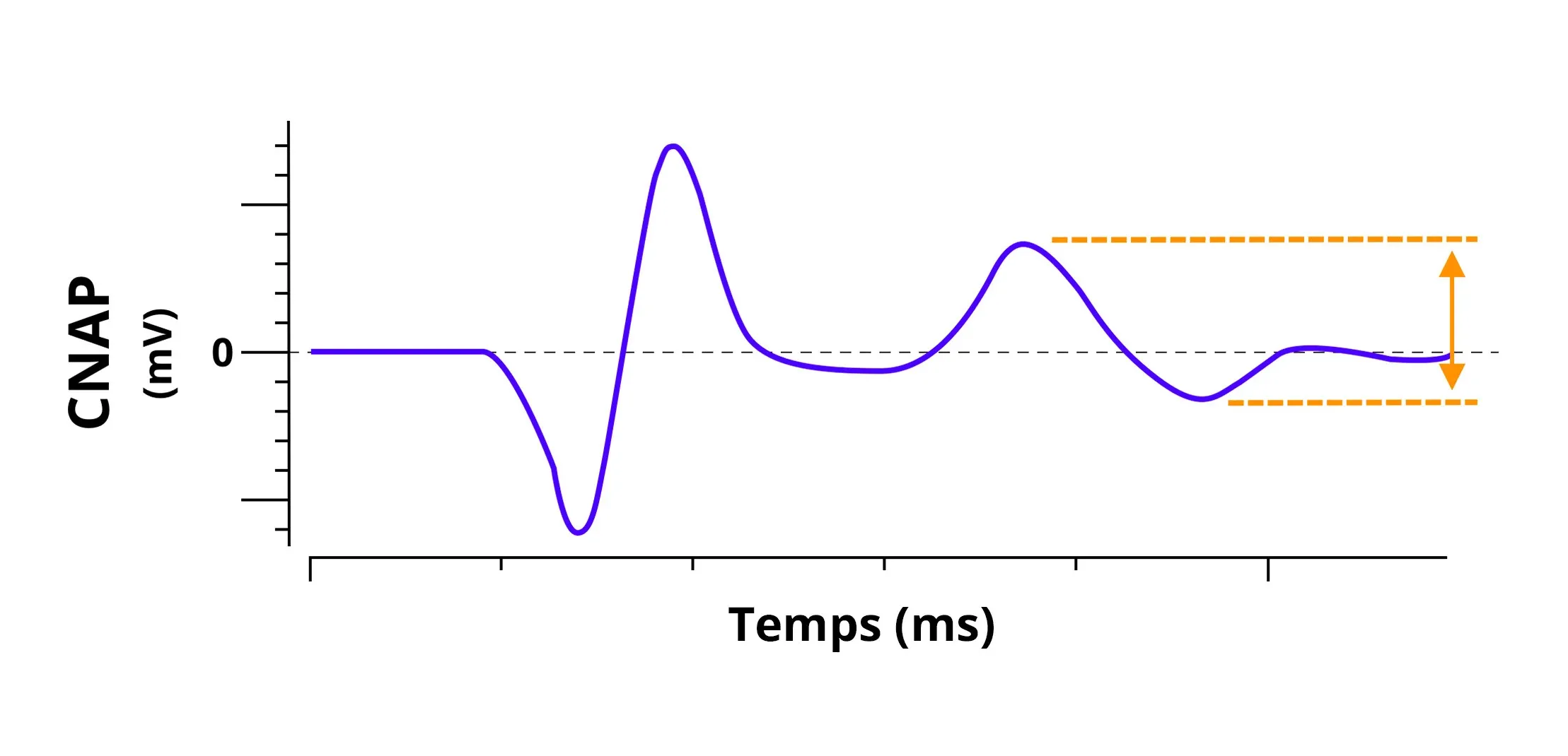 Electrophysiologie - Graphique CNAP