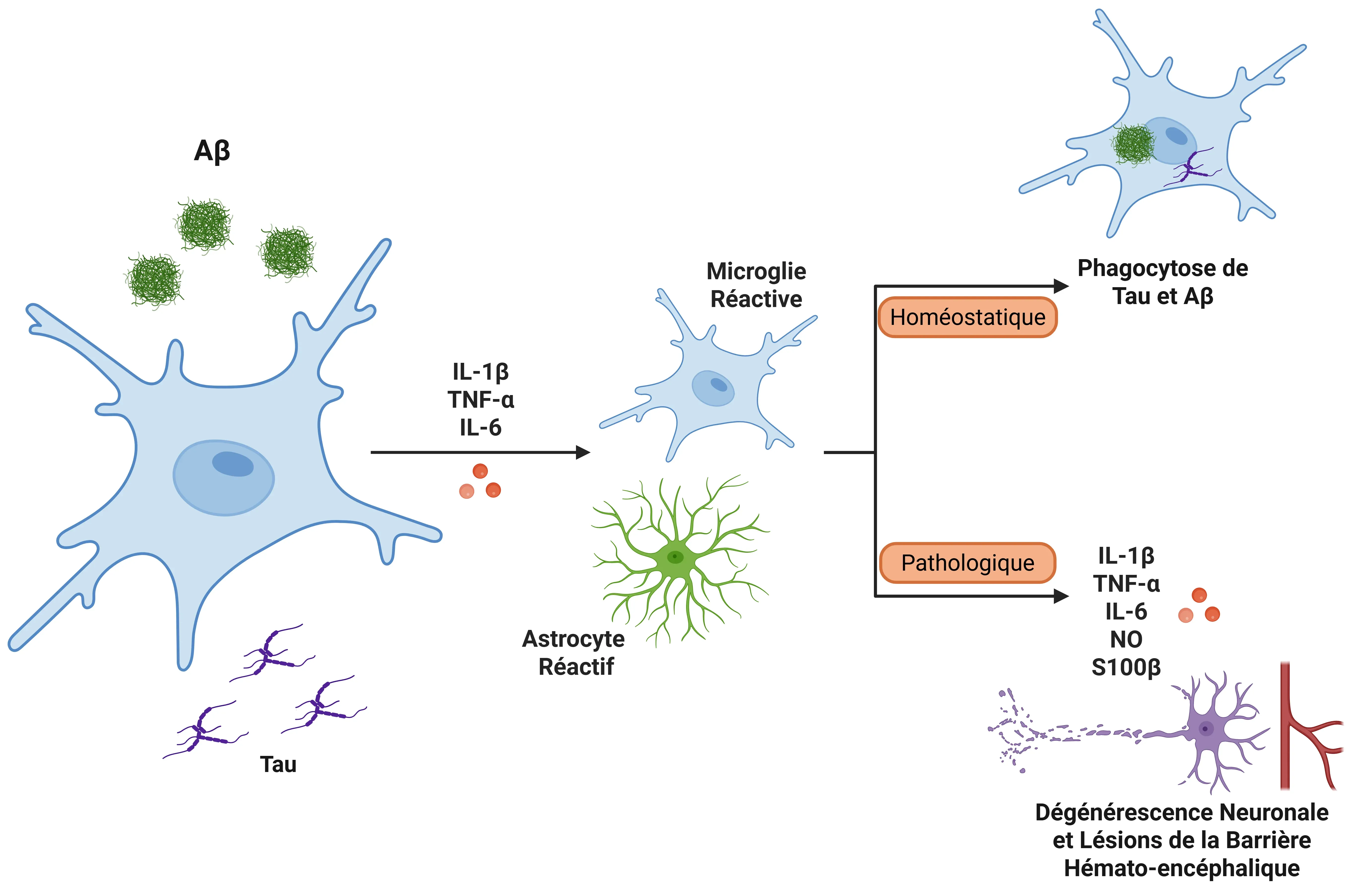 L'IL-1β dans la maladie d'Alzheimer (MA)