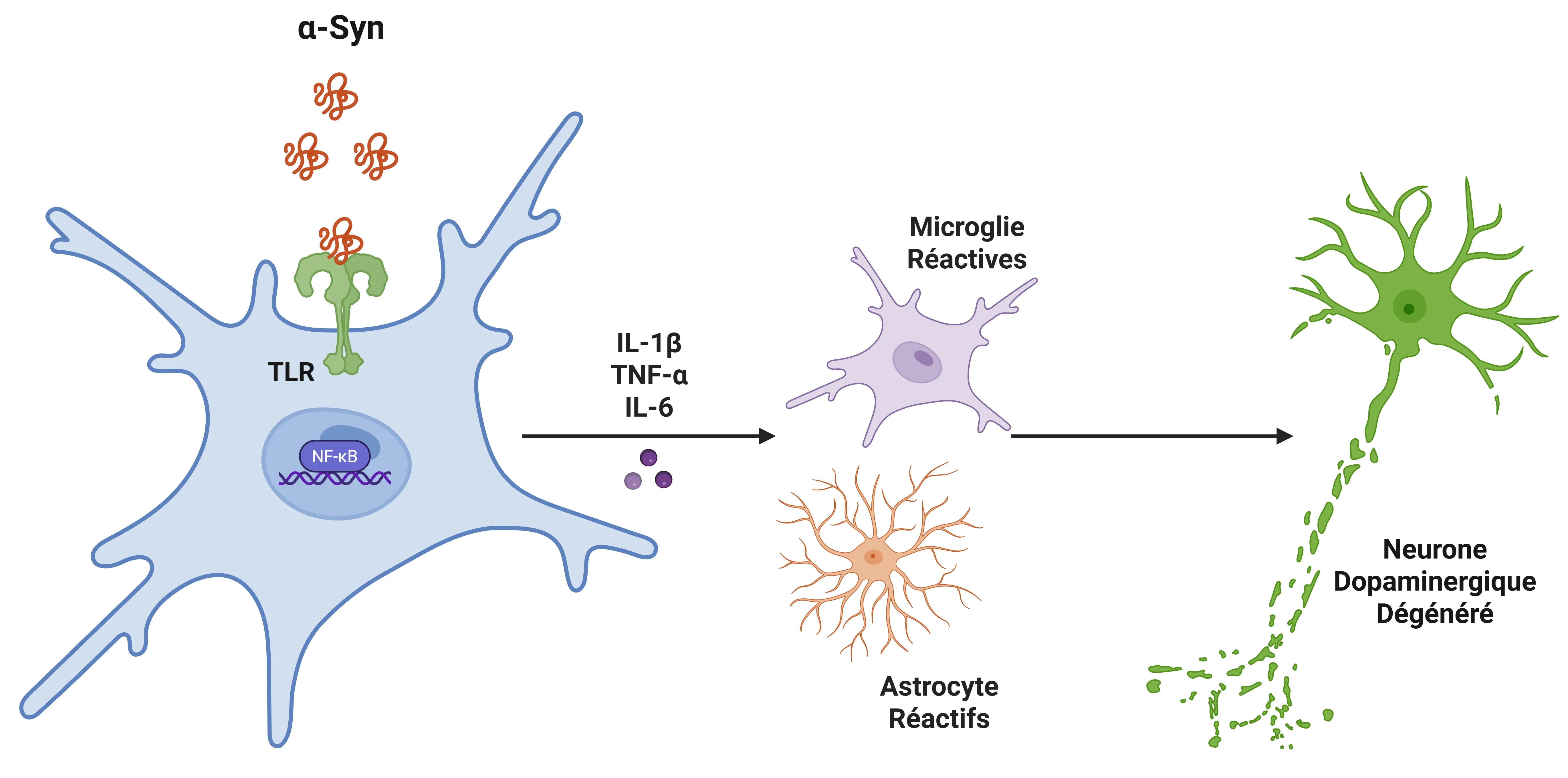 L'IL-1β dans la maladie de Parkinson (MP)