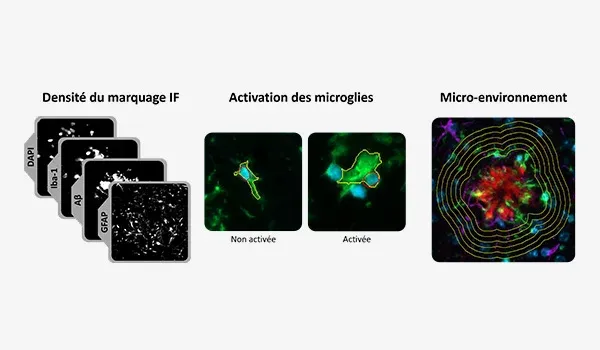 Composé de trois images microscopiques ou scanners différents, chacun illustrant un aspect différent de l'analyse des tissus biologiques, potentiellement dans le contexte de la neurobiologie.