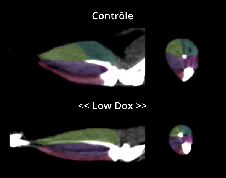 Image tomodensitométrique avec segmentation des muscles des membres postérieurs de souris témoins (sous dox) et de souris à faible dose de dox.