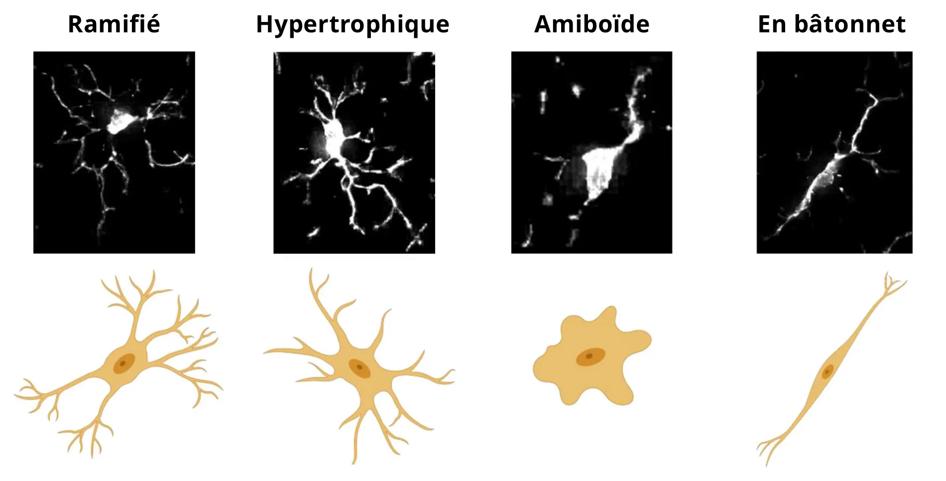 Images de microscopie et représentations schématiques de quatre morphologies sélectionnées de la microglie.