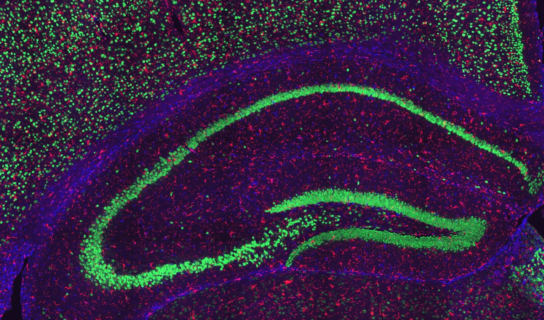 野生型マウスの海馬におけるIF染色像 
