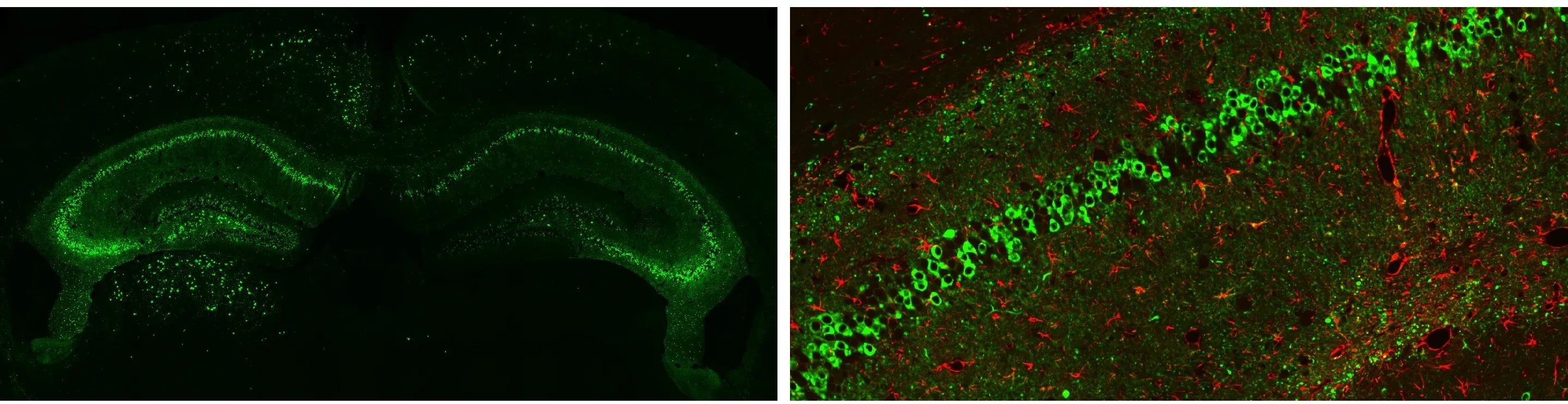 AT8 IF staining in Tau PFF-injected PS19 mice