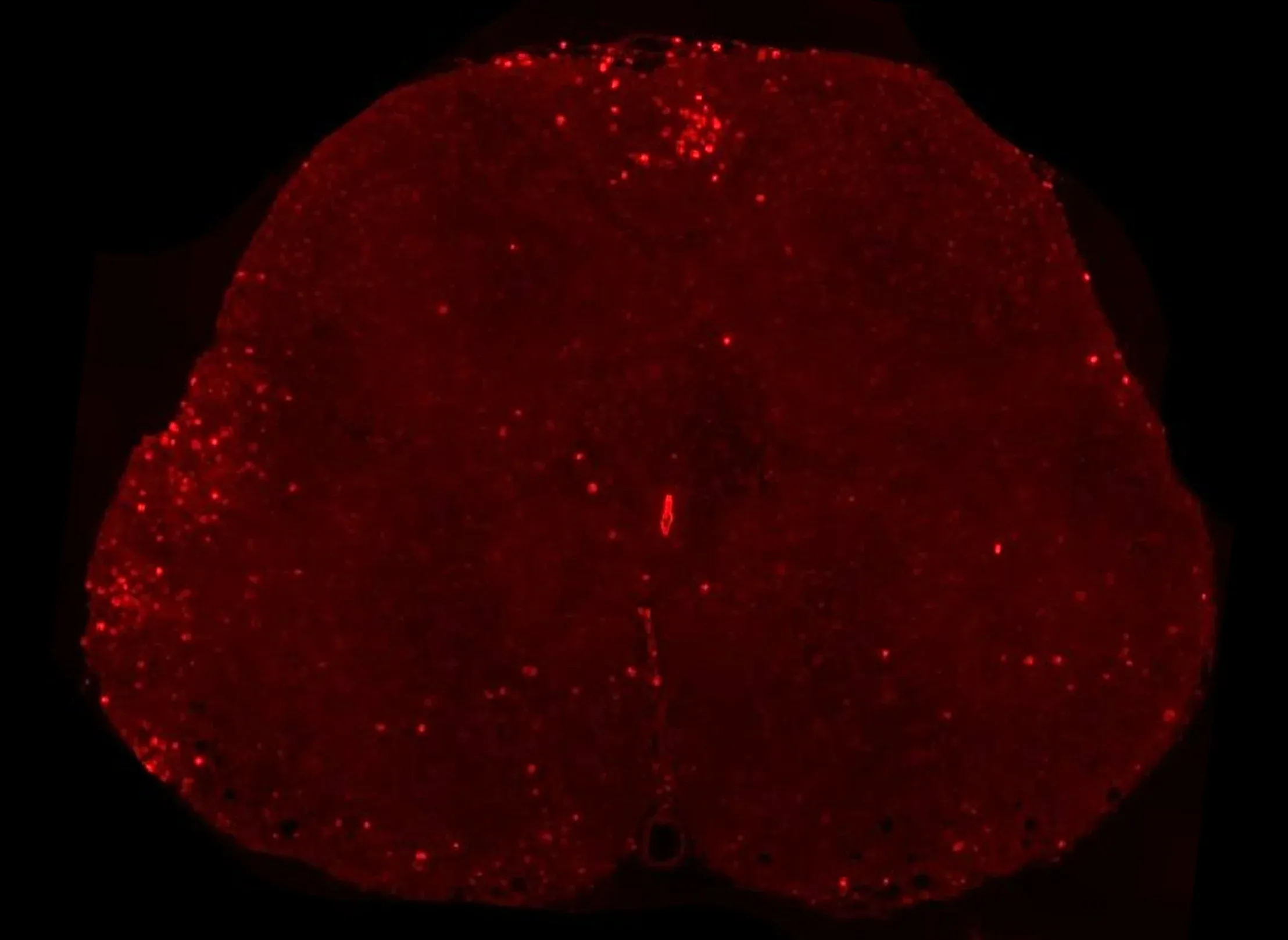 Immunofluorescence - CD3 in EAE spinal cord