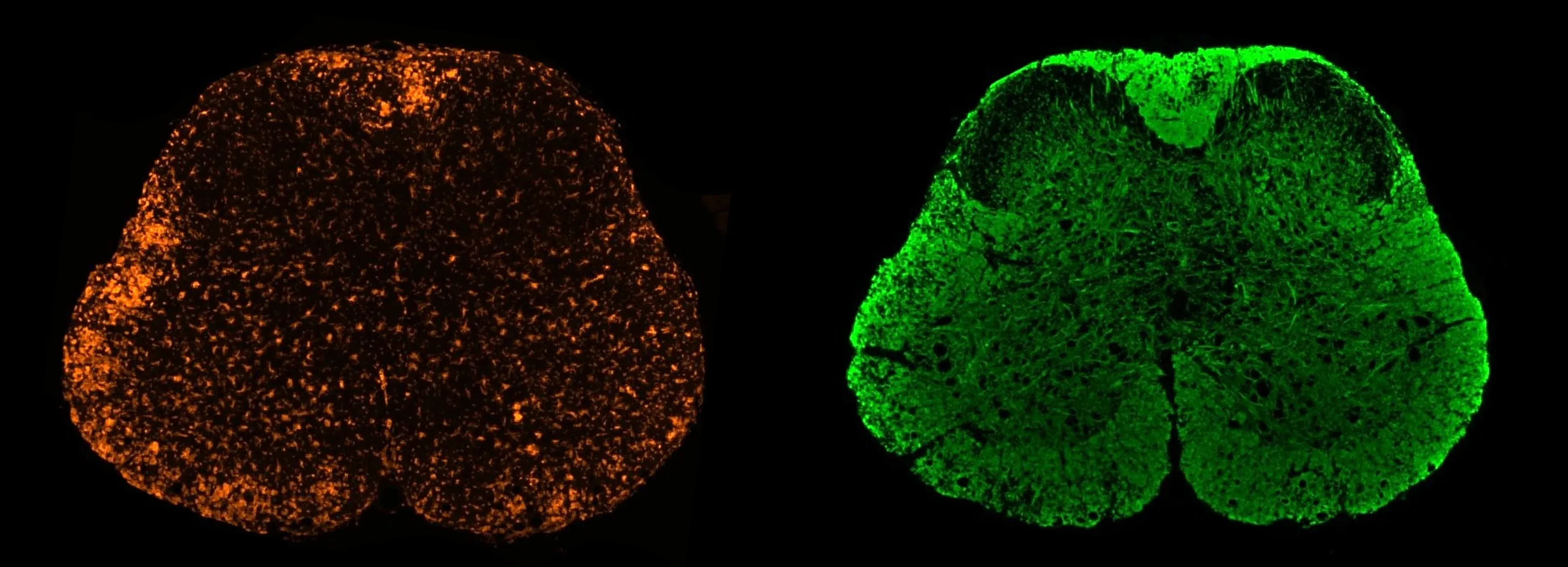 mIF - Iba1 and MBP in EAE spinal cord