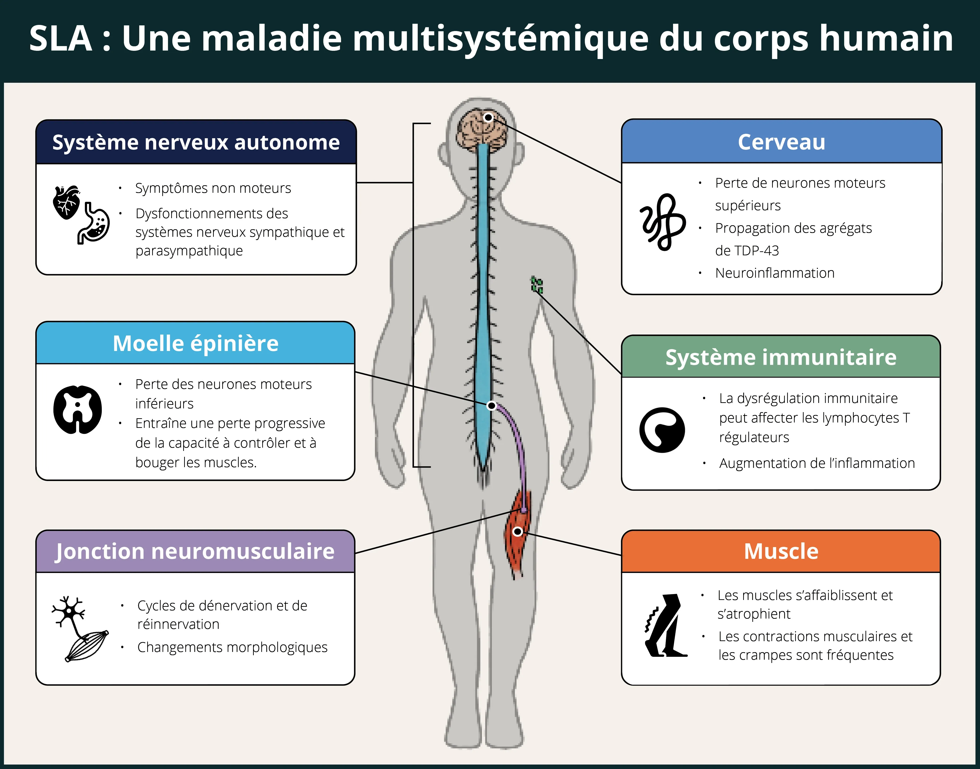 Effets multisystèmes de la SLA sur le corps humain