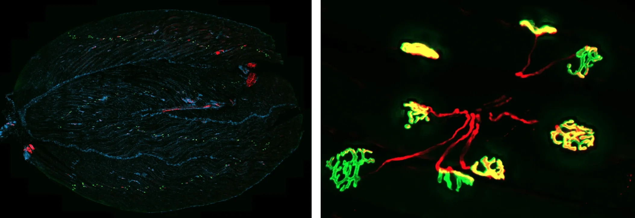 マウス腓腹筋における神経筋接合部（NMJ）の画像 