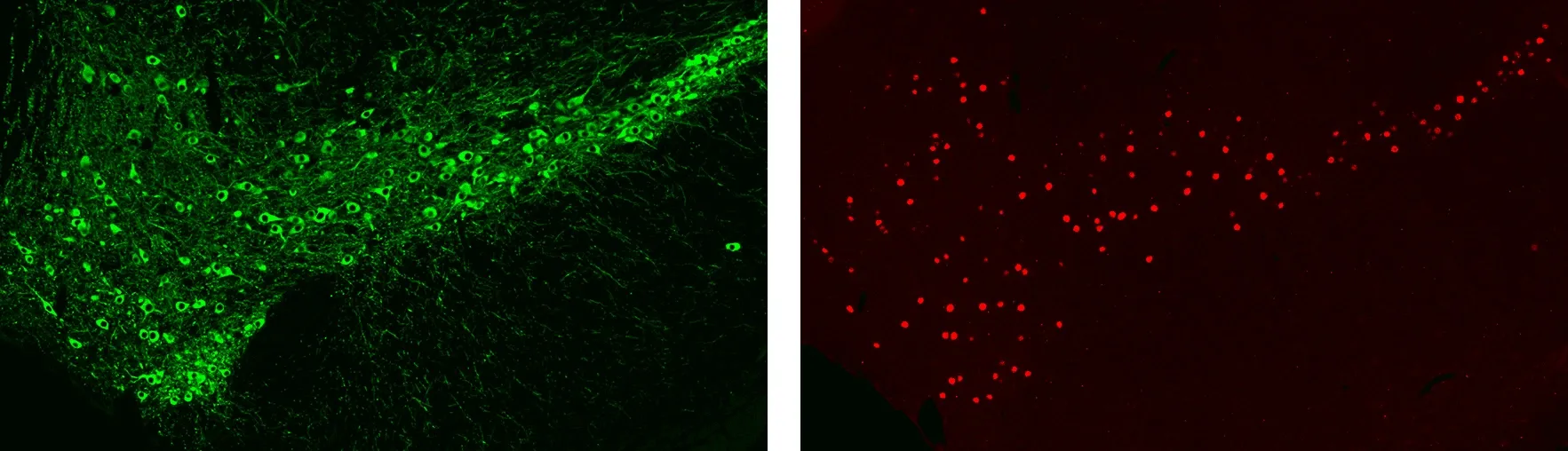 マウス黒質におけるドーパミン作動性細胞体・突起および神経核の免疫蛍光（IF）染色