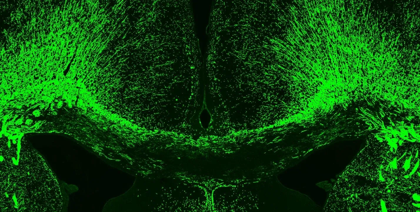 IF image of demyelination in the corpus callosum of cuprizone model