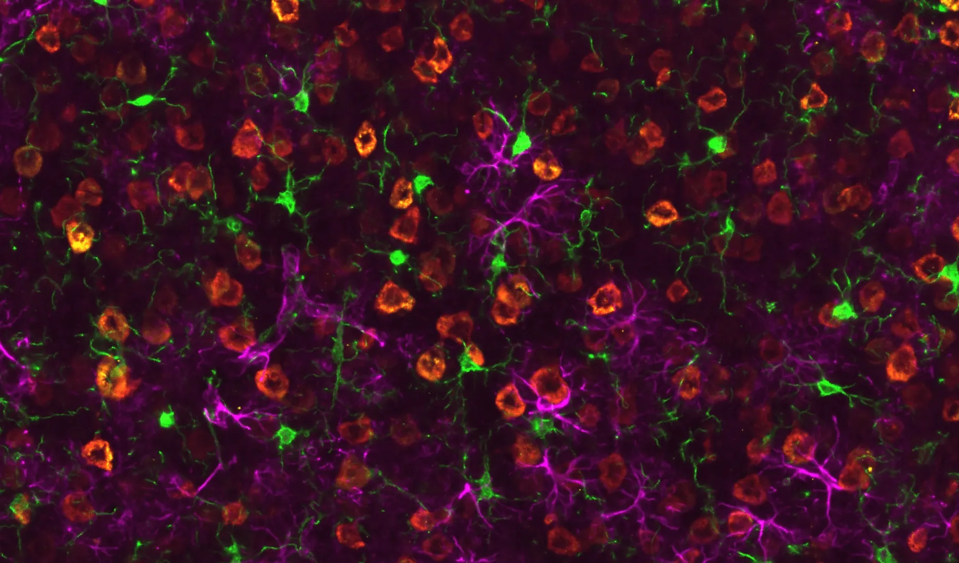 rNLS8（TDP-43ΔNLS）マウスの運動皮質におけるTDP-43病理およびグリア活性化を示す画像