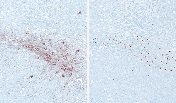 Immunohistochemistry (IHC) staining of the mouse substantia nigra