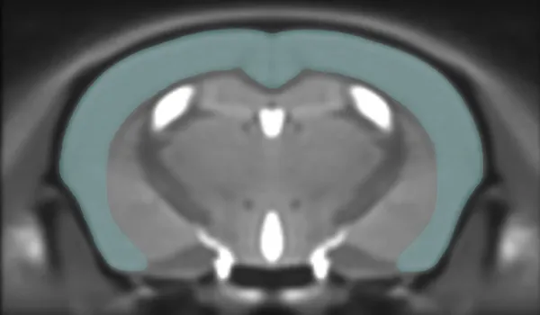 In Vivo Imaging of mouse brain