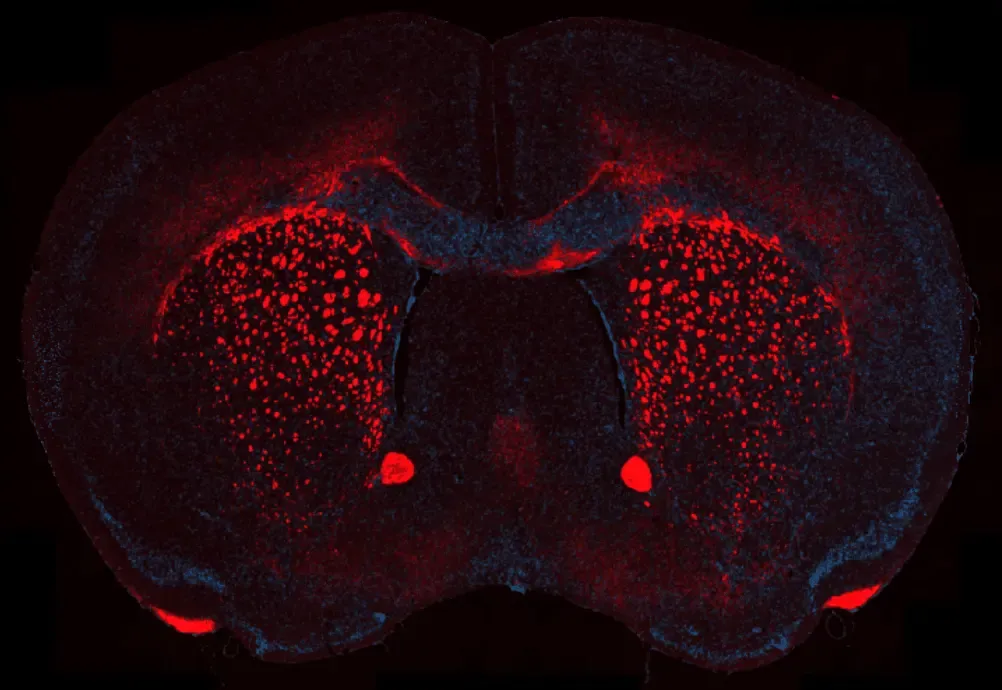 クプリゾン脱髄モデルにおける髄鞘喪失の画像 