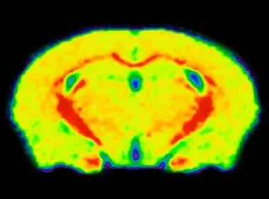 MRI Control _ Cuprizone