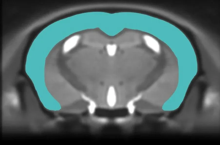 Mouse MRI image with segmented cerebral cortex