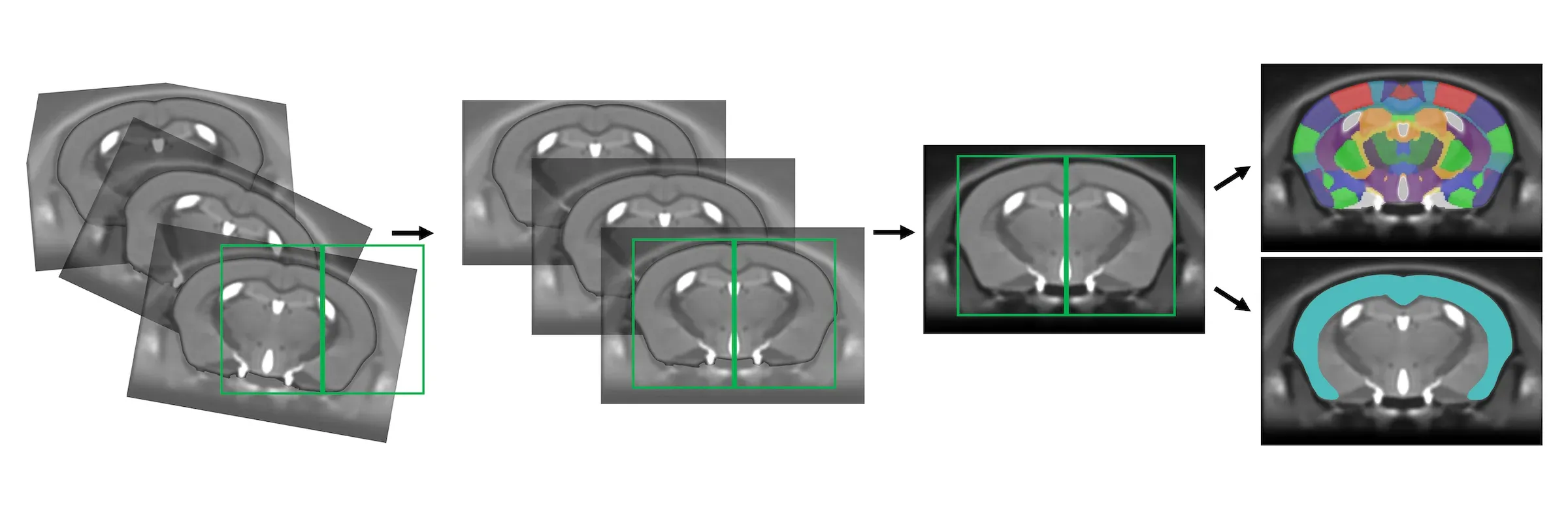 MRI Processing Pipeline