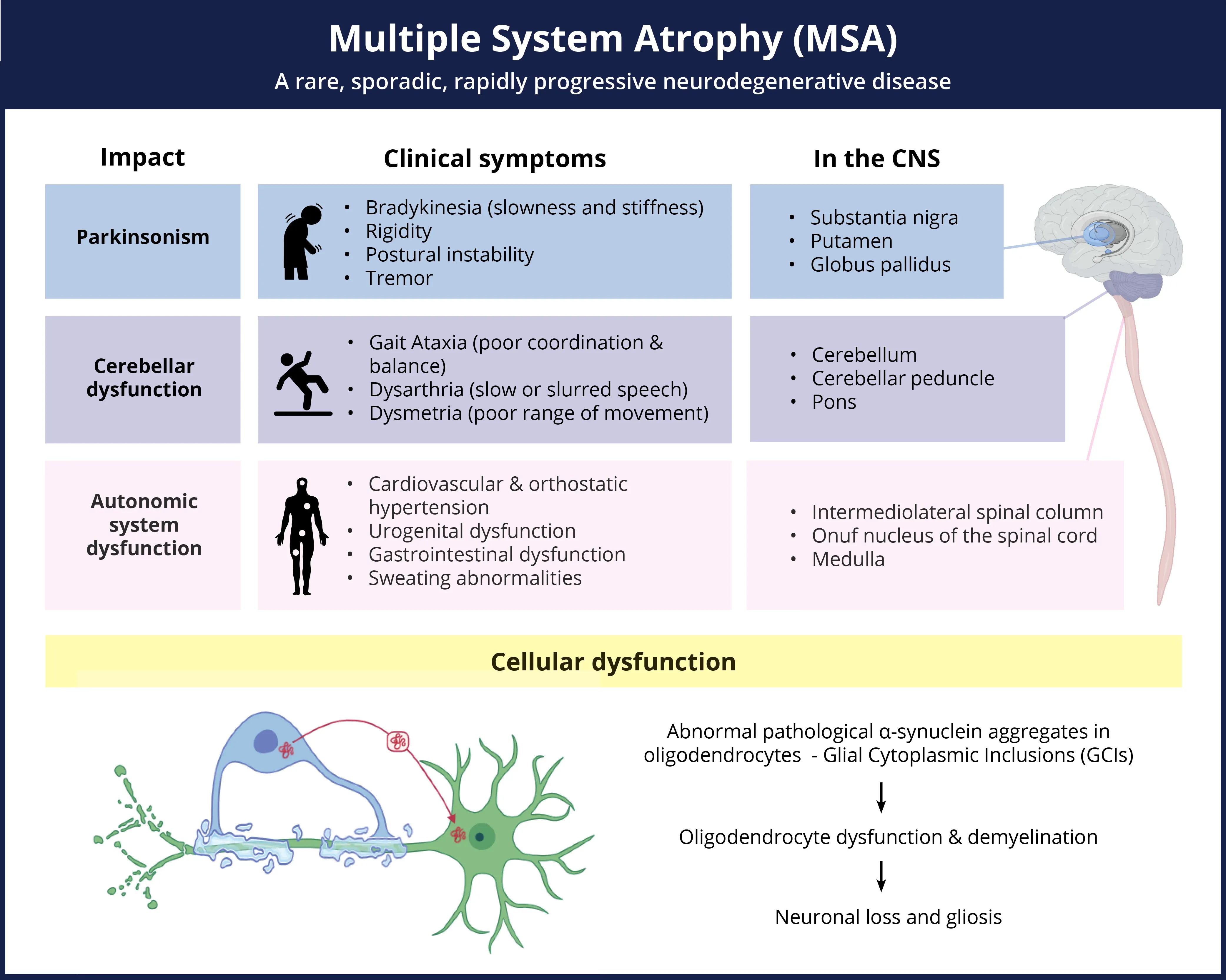 Symptoms of Multiple System Atrophy and pathologic changes throughout the CNS