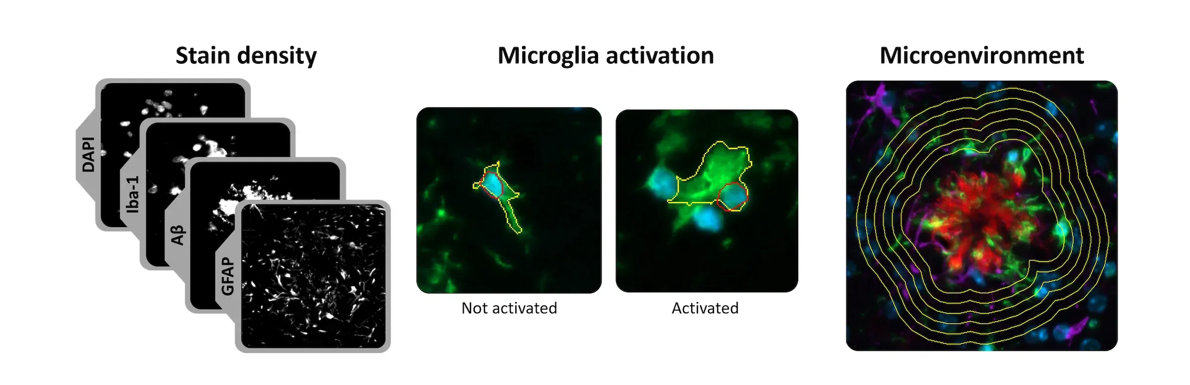 A composite of three different microscopic images or scans, each illustrating a different aspect of biological tissue analysis, potentially within the context of neurobiology