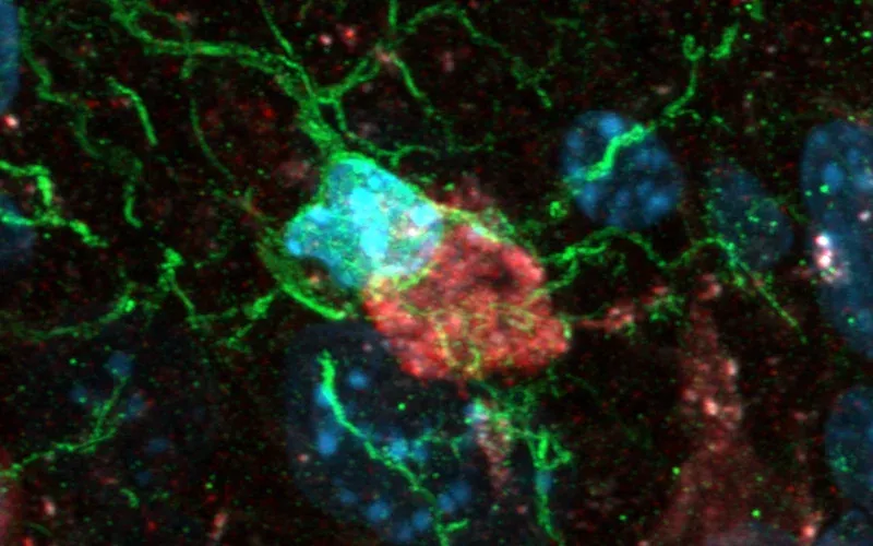 Neuron Microglia Interaction
